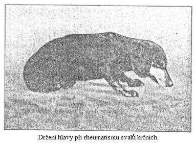 Držení hlavy při rheumatismu svalů krčních.